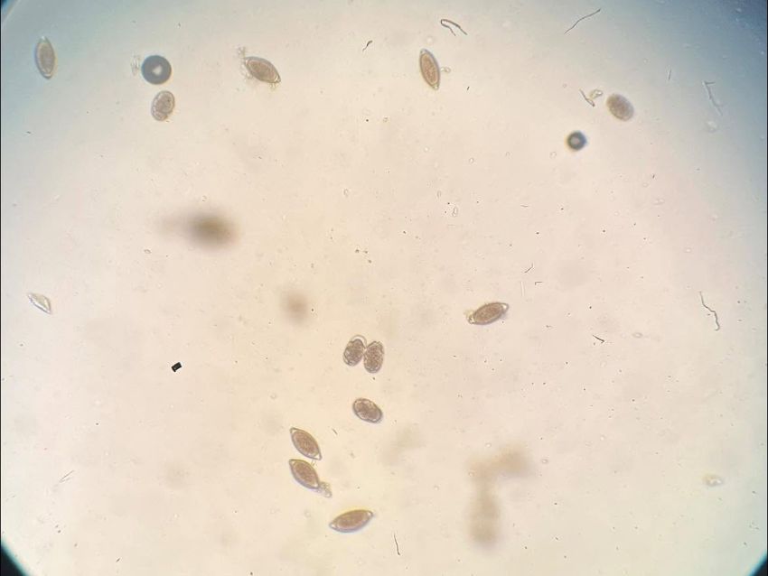 Parasites in a microscope
