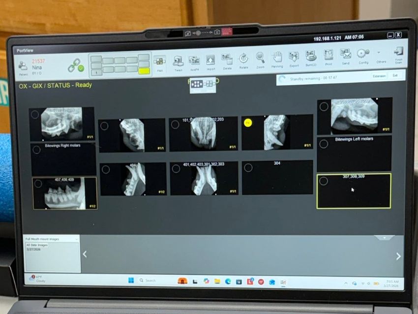 xrays on a laptop